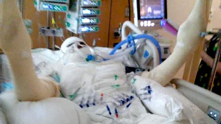 Mom Speaks Out After Girl, 12, Sets Herself on Fire While Attempting Viral ‘Fire Challenge'