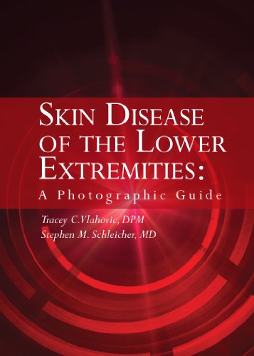 Skin Disease of the Lower Extremities: A Photographic Guide