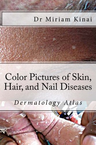 Color Pictures of Skin, Hair and Nail Diseases: Dermatology Atlas