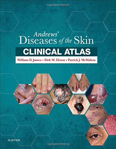 Andrews' Diseases of the Skin Clinical Atlas, 1e
