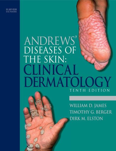 Andrews' Diseases of the Skin: Clinical Dermatology, 10e (James, Andrew's Disease of the Skin)