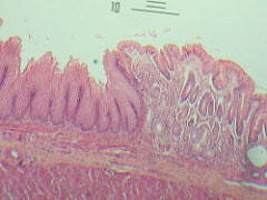esophagus